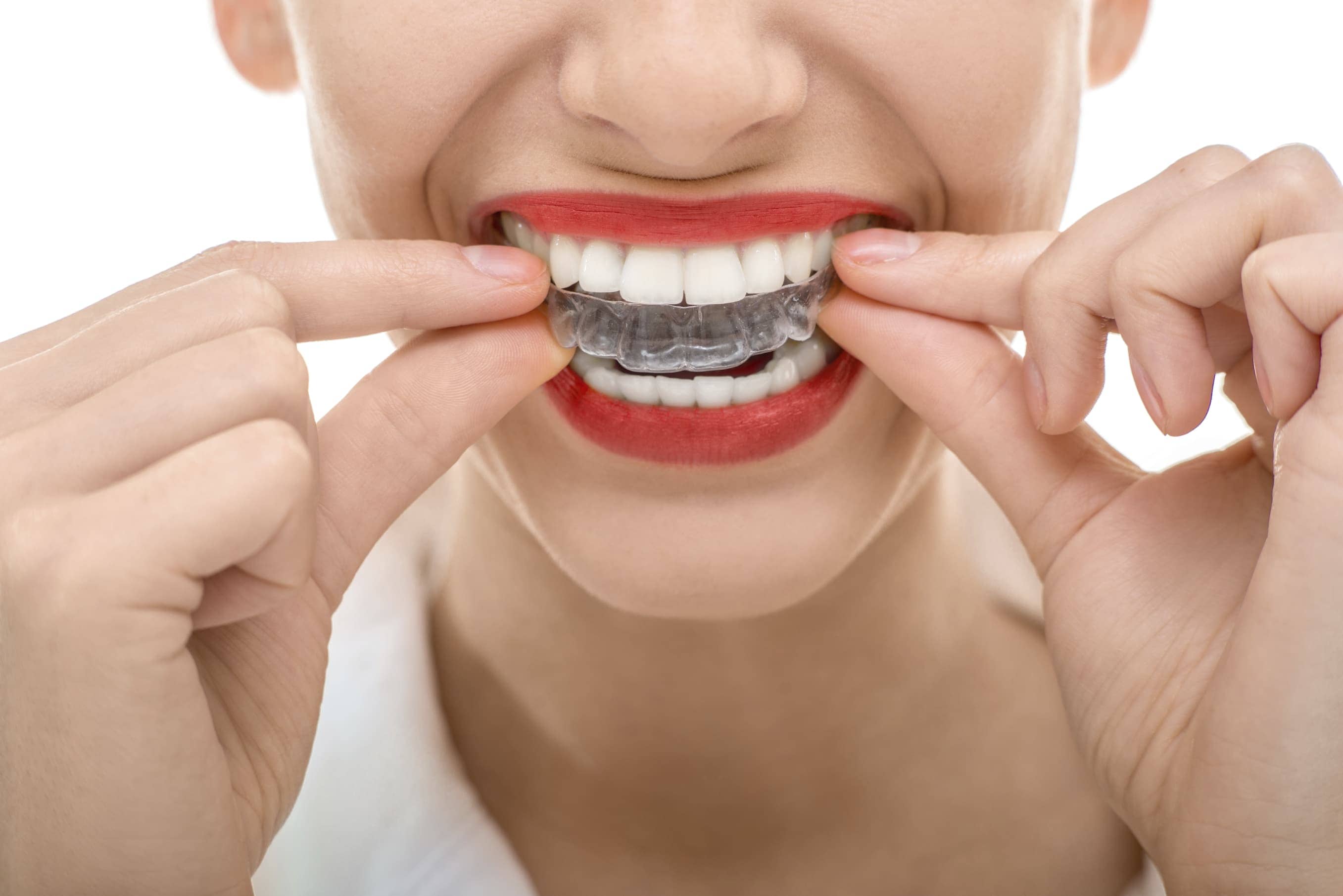 orthodontic options for all ages