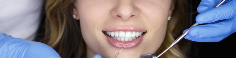 7 reasons to choose professional teeth whitening